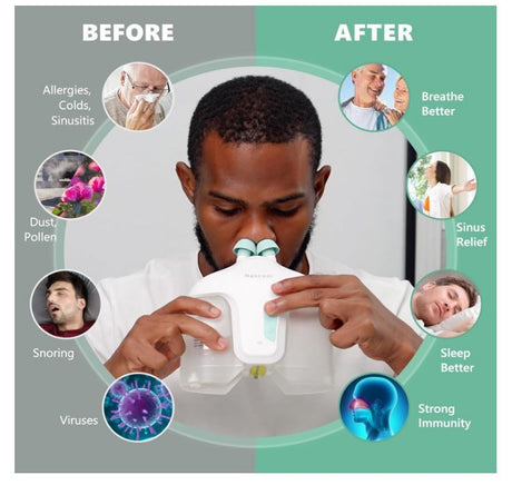 Electric Nasal Irrigation System with 50 Salt Packets, 2 Modes Nose Cleaner with SelfCleaning & Auto Waste Collection Function for Sinus Relief Runny Nose, Nasal Congestion, Itching Nose